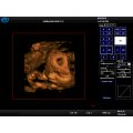 Krankenhaus benutzte 3D 4D Ultraschallscanner &amp; Farbdopplerpreis